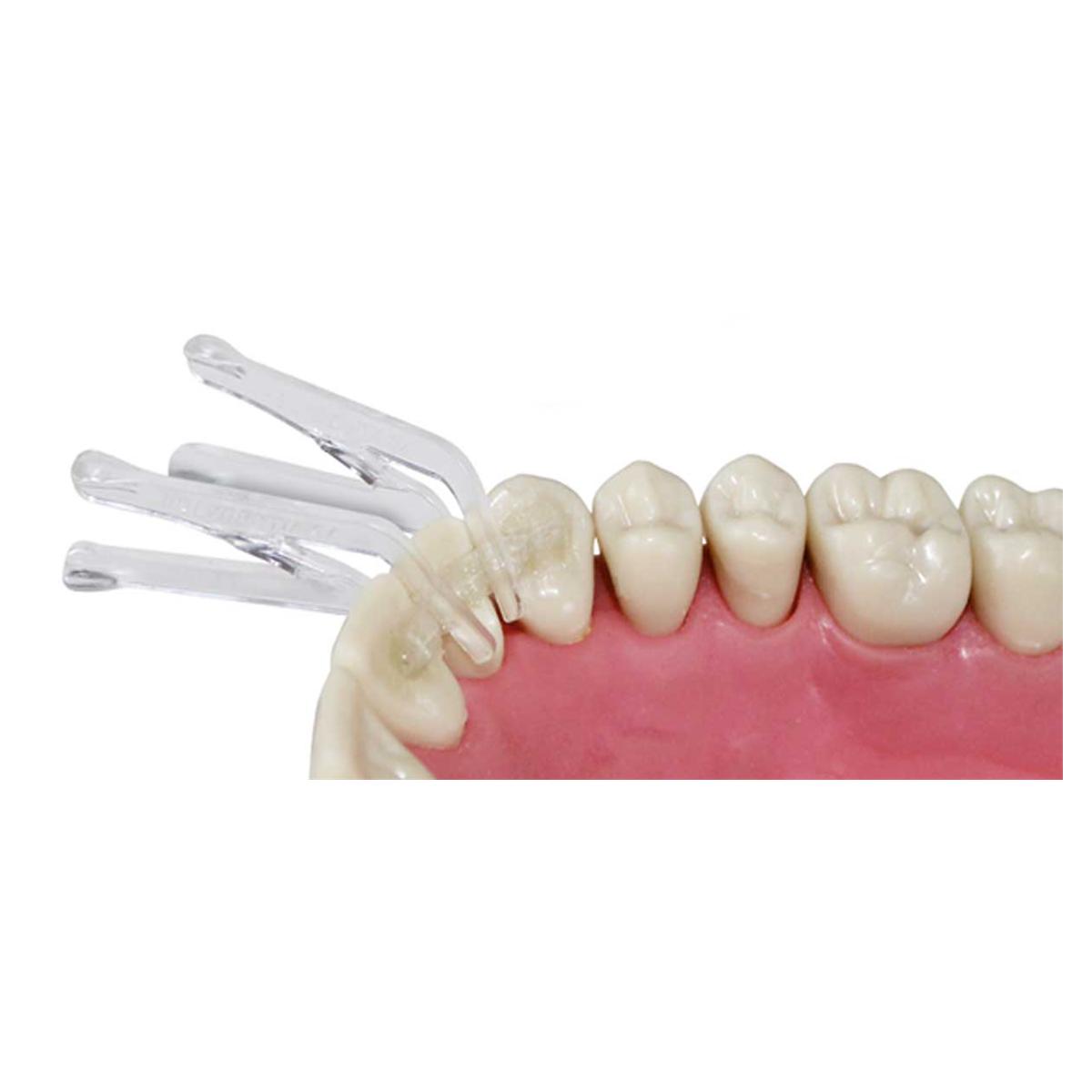 CLIP & SPLINT