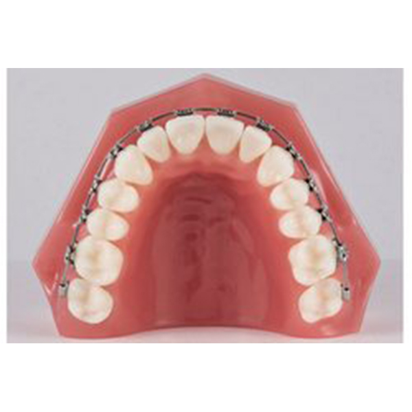 ARCOS NITI TERMICO TRIFECTA 016X016 INFERIORES