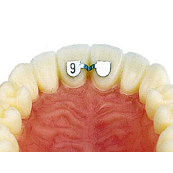 RETENEDOR LINGUAL 6MM