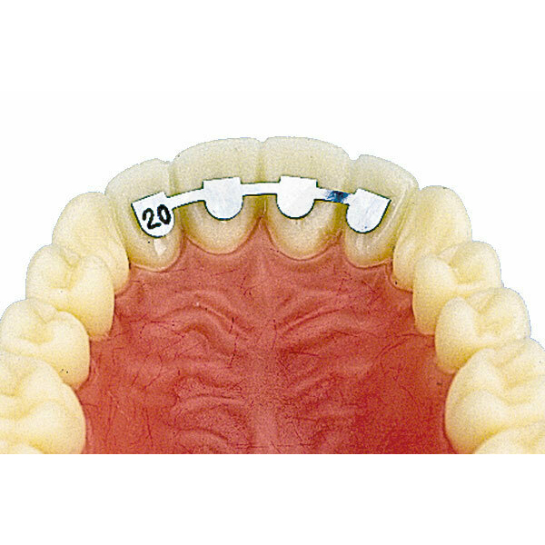 RETENEDOR LINGUAL 14mm