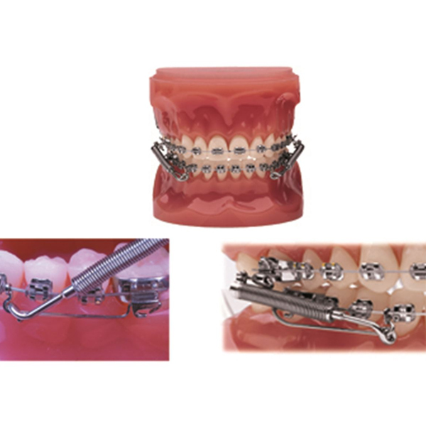 CORRECTOR DE CLASE II - FORSUS EZ KIT 5 PACIENTES