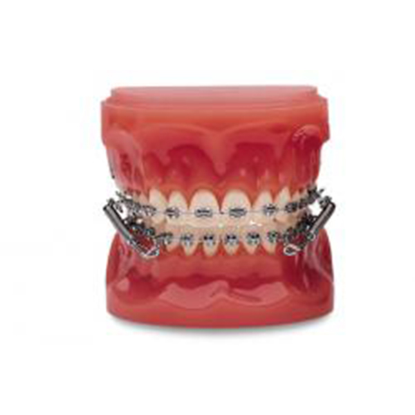 CORRECTOR DE CLASE II - FORSUS EZ KIT 20 PACIENTES