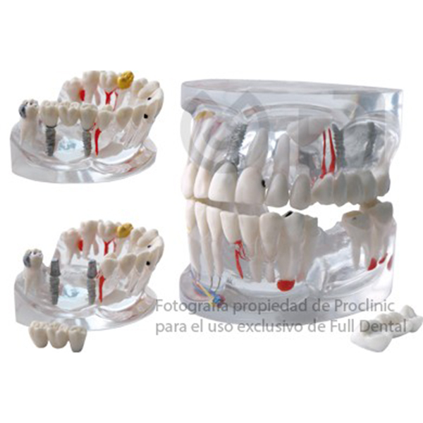 MODELO TRANSPARENTE DS0800 UNIVERSAL