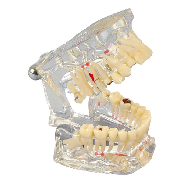 MODELO DE ESTUDIO TRANSPARENTE DELUXE